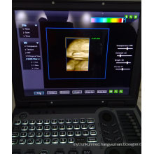 Portable Color Doppler Ultrasound with CE